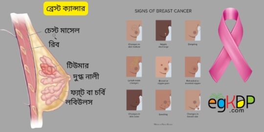 Breast Cancer er Lokkhon bangla স্তন ক্যান্সারের লক্ষণ কি কি বাংলা কন্টেন্ট